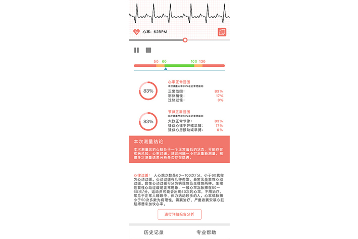 智能手环APP开发是否具有市场收益